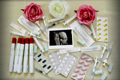 IVF postupak IVF postupak, VTO, vantjelesna oplodnja