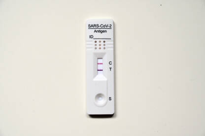 Pozitivan rezultat Covid testa. Covid-19 Pozitivan rezultat Covid testa pomoću testa na antigen. Komplet za testiranje na Covid-19. Brzi dijagnostički test za otkrivanje korona virusa. Samotestiranje kod kuće.