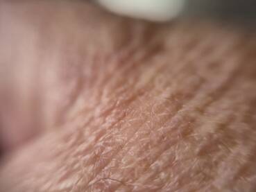 Krupni kadar ljudske kože